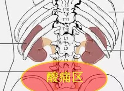 肾疼和腰疼的区别图（腰疼的区别图解 位置图）
